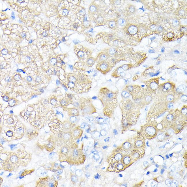 Haptoglobin Antibody in Immunohistochemistry (Paraffin) (IHC (P))