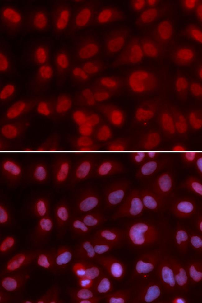 SIN3A Antibody in Immunocytochemistry (ICC/IF)