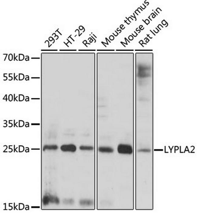 LYPLA2 Antibody in Western Blot (WB)