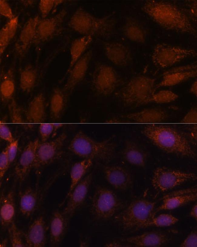 GCAT Antibody in Immunocytochemistry (ICC/IF)