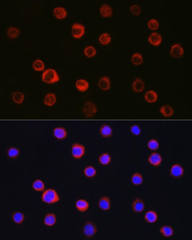 CD11b Antibody in Immunocytochemistry (ICC/IF)