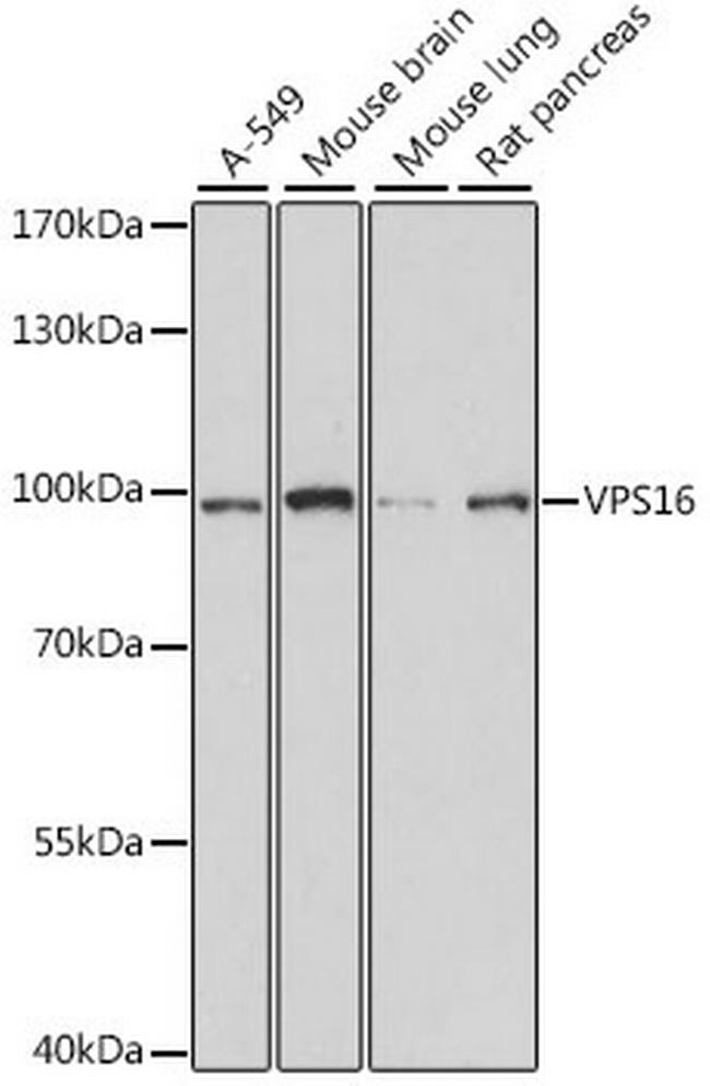 VPS16 Antibody in Western Blot (WB)