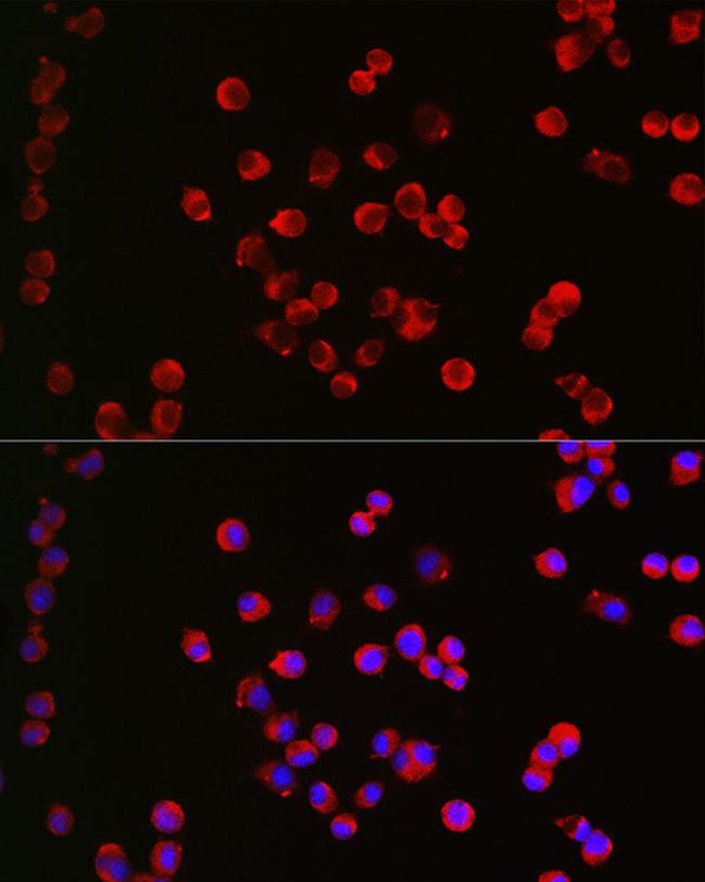 CHRM1 Antibody in Immunocytochemistry (ICC/IF)