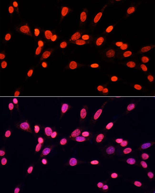 Di-Methyl-DNMT3A (Lys44) Antibody in Immunocytochemistry (ICC/IF)