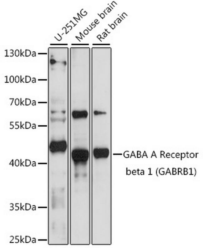 GABRB1 Antibody in Western Blot (WB)