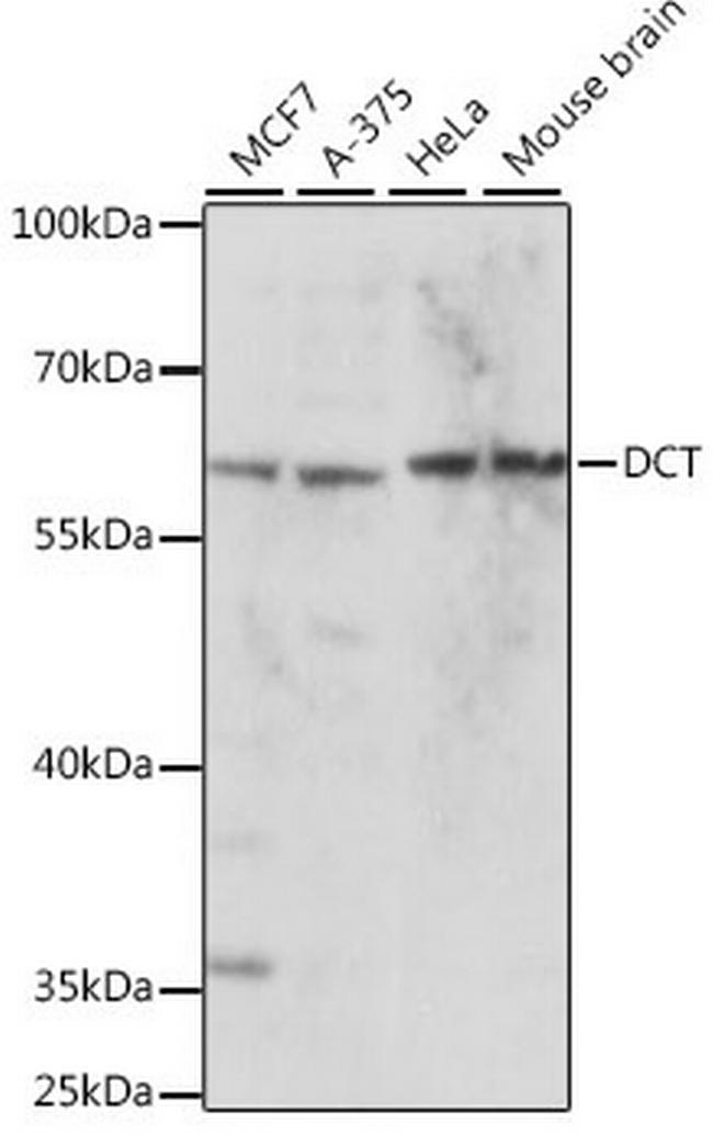 DCT Antibody in Western Blot (WB)