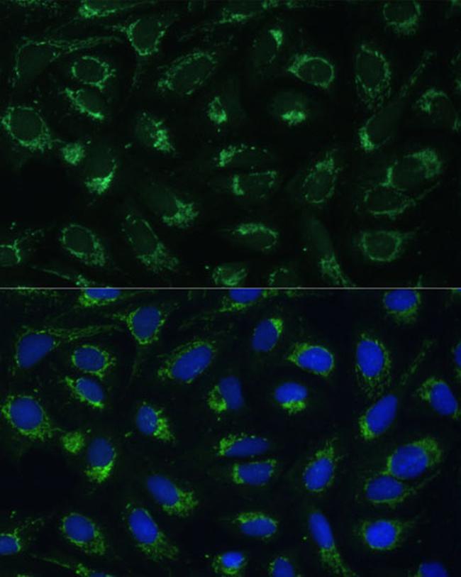 ETFB Antibody in Immunocytochemistry (ICC/IF)