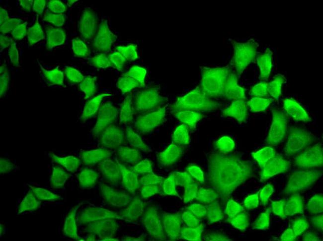 DHFR Antibody in Immunocytochemistry (ICC/IF)