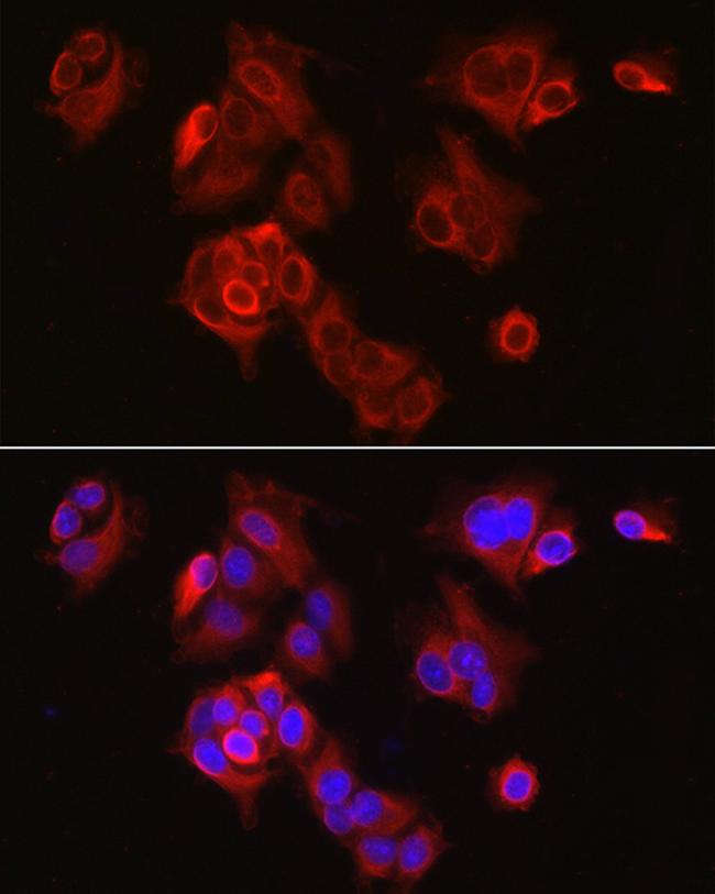 SLC7A5 Antibody in Immunocytochemistry (ICC/IF)