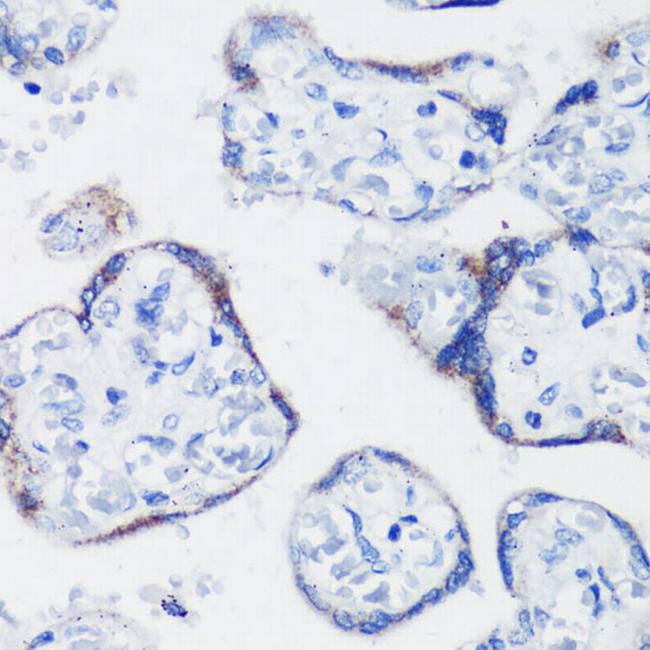 KISS1 Antibody in Immunohistochemistry (Paraffin) (IHC (P))