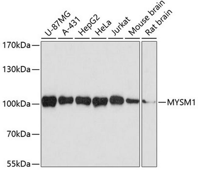 MYSM1 Antibody in Western Blot (WB)