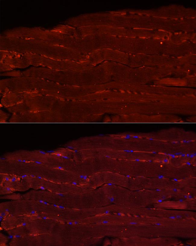 FBXO32 Antibody in Immunohistochemistry (Paraffin) (IHC (P))