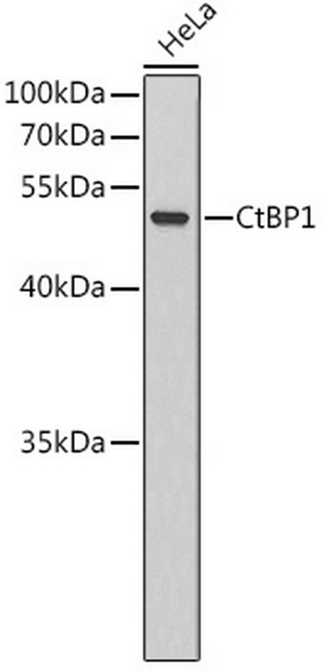 CtBP1 Antibody in Western Blot (WB)