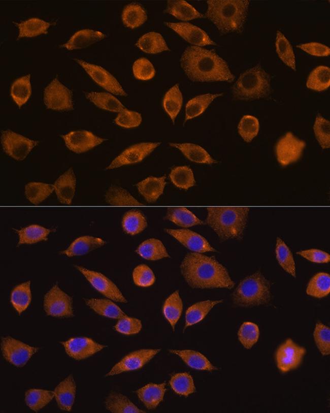 DOCK2 Antibody in Immunocytochemistry (ICC/IF)