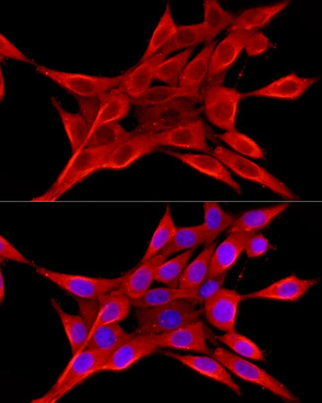 ELOVL4 Antibody in Immunocytochemistry (ICC/IF)