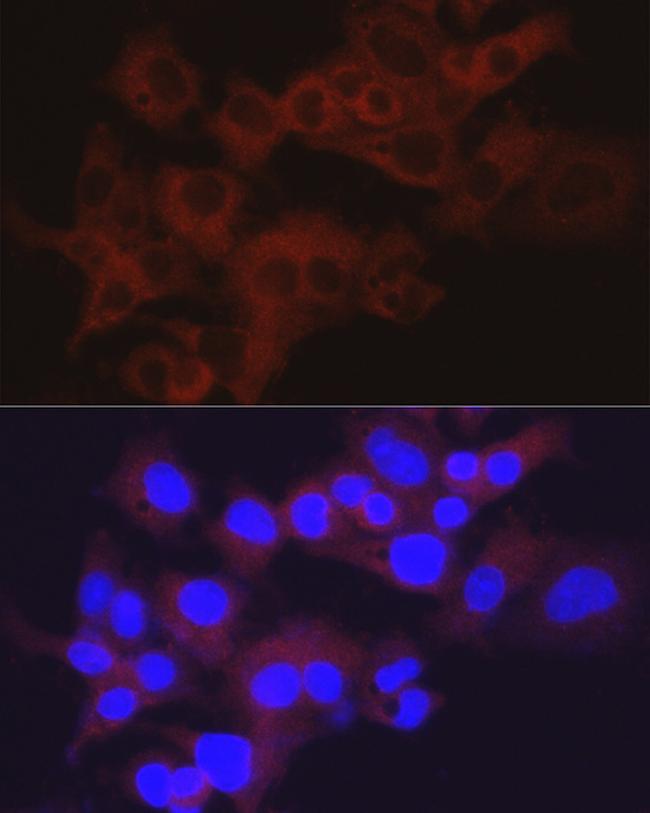 Aldolase B Antibody in Immunocytochemistry (ICC/IF)