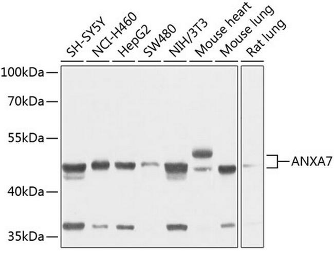 Annexin A7 Antibody in Western Blot (WB)