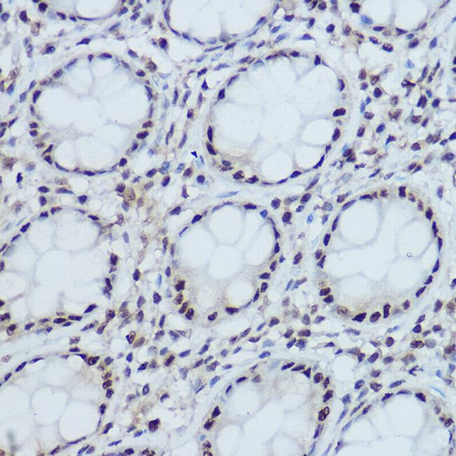 DDB1 Antibody in Immunohistochemistry (Paraffin) (IHC (P))