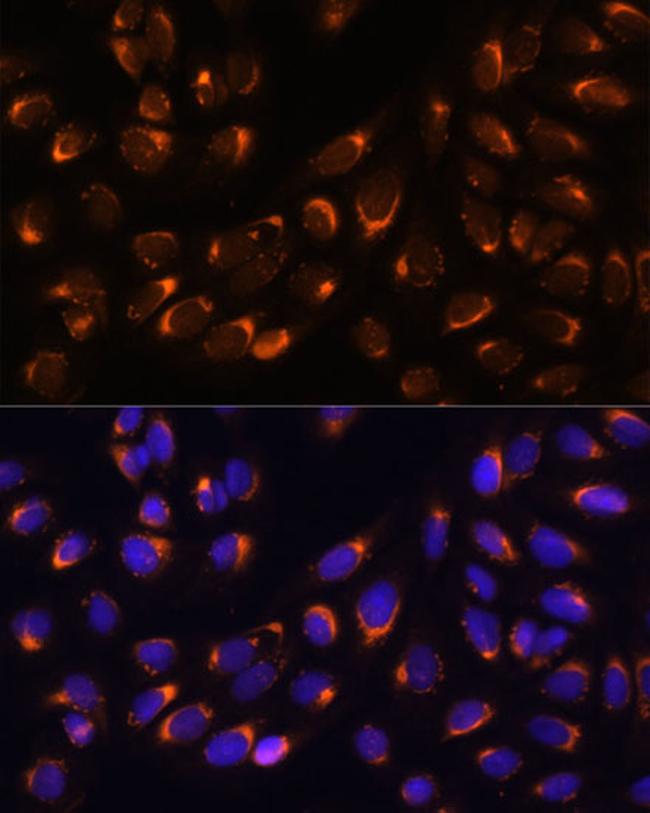 Nucleobindin 1 Antibody in Immunocytochemistry (ICC/IF)