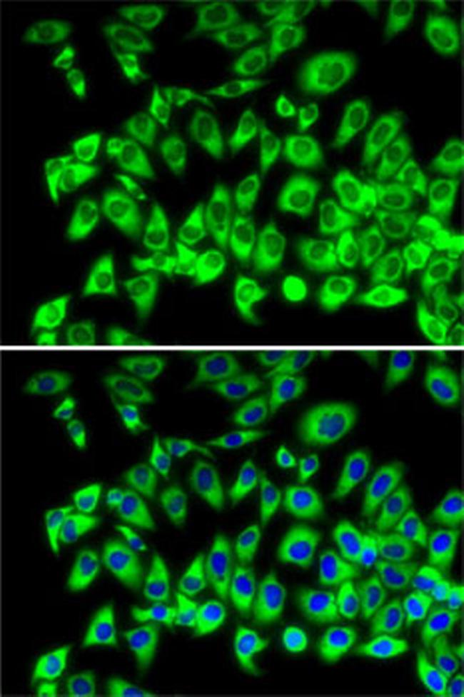 RPL13 Antibody in Immunocytochemistry (ICC/IF)