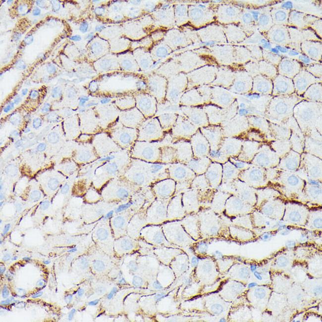 IFITM1 Antibody in Immunohistochemistry (Paraffin) (IHC (P))