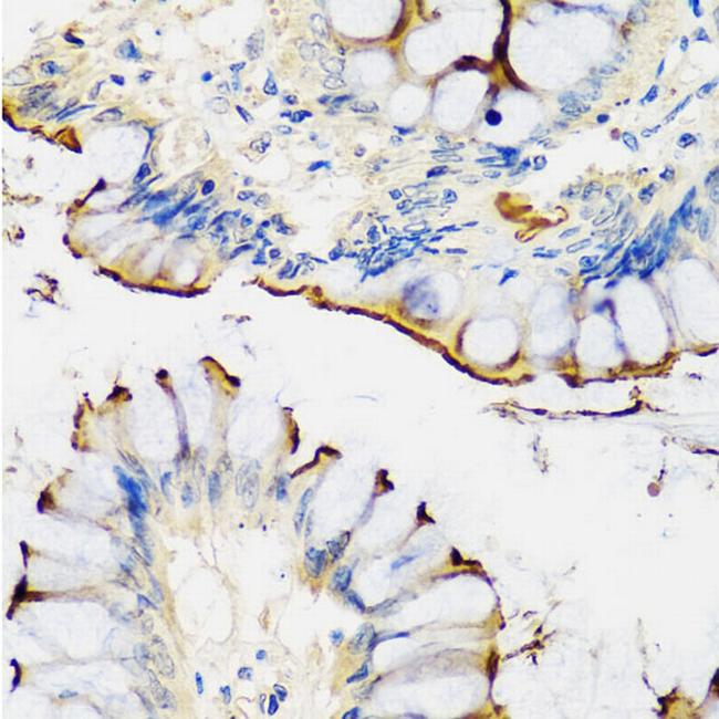 CRTAP Antibody in Immunohistochemistry (Paraffin) (IHC (P))