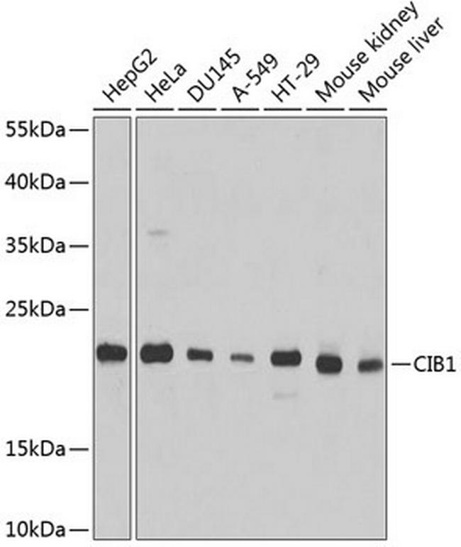 Calmyrin Antibody in Western Blot (WB)