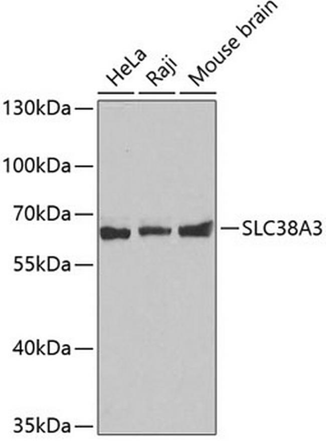 SLC38A3 Antibody in Western Blot (WB)