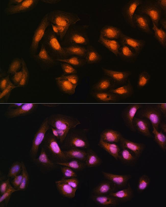 ADRM1 Antibody in Immunocytochemistry (ICC/IF)