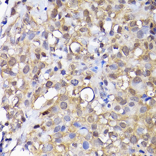 ADI1 Antibody in Immunohistochemistry (Paraffin) (IHC (P))