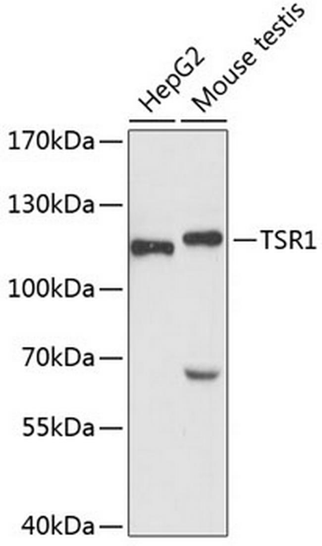 TSR1 Antibody in Western Blot (WB)