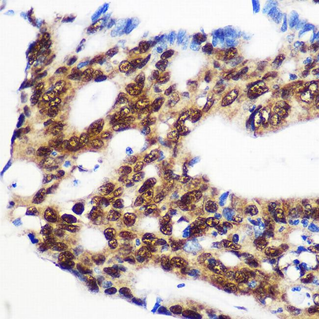 RBM15 Antibody in Immunohistochemistry (Paraffin) (IHC (P))