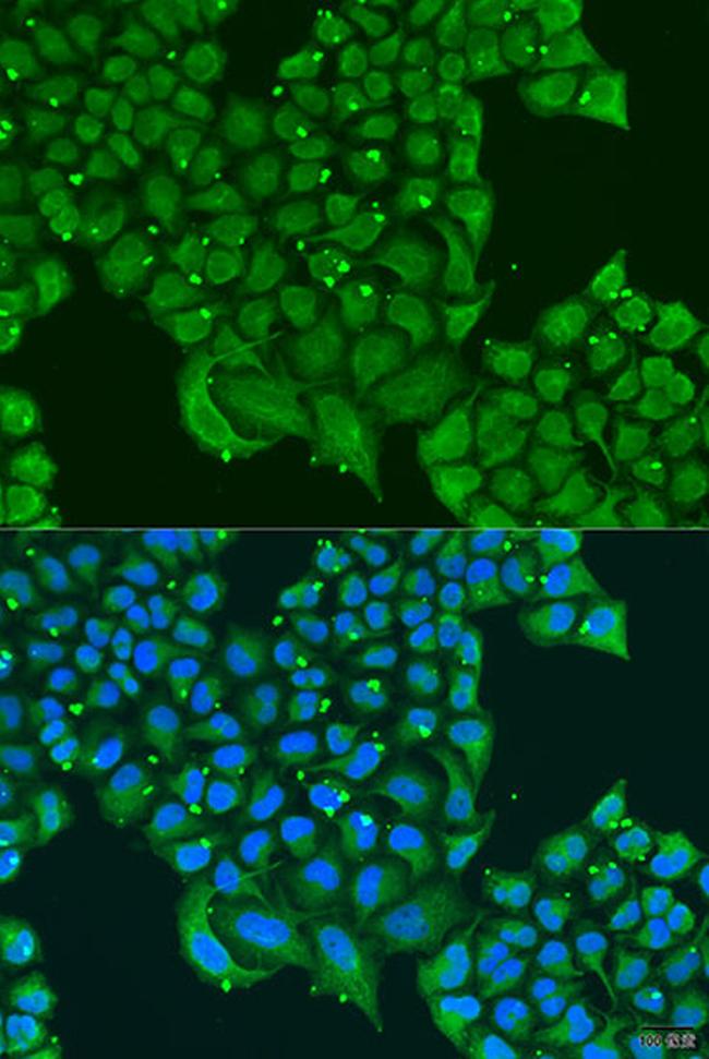 ATPIF1 Antibody in Immunocytochemistry (ICC/IF)