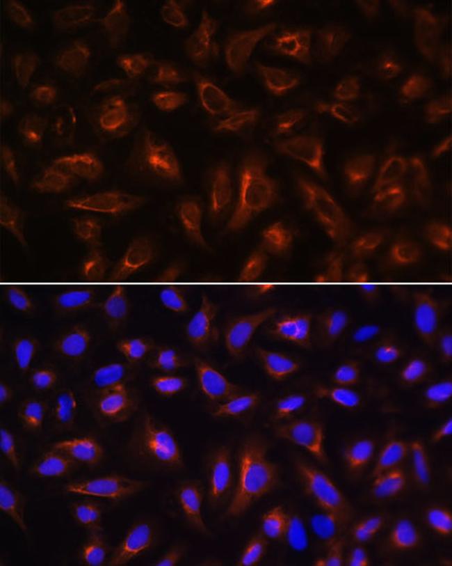 ARL13B Antibody in Immunocytochemistry (ICC/IF)