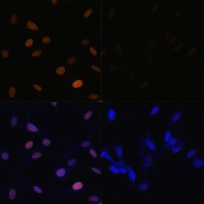 H4K16ac Antibody in Immunocytochemistry (ICC/IF)