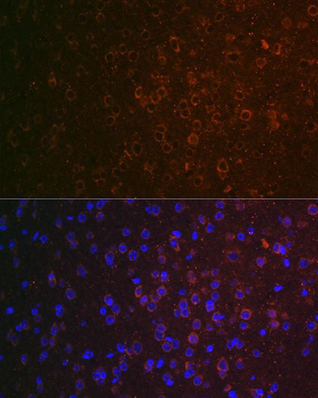 ABAT Antibody in Immunohistochemistry (Paraffin) (IHC (P))