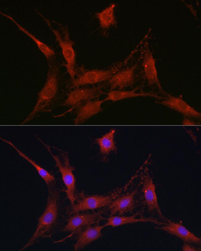 SLC4A4 Antibody in Immunocytochemistry (ICC/IF)