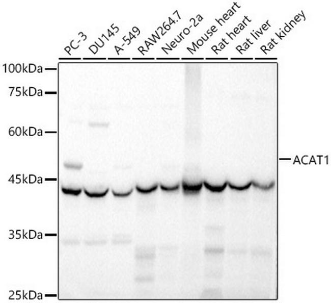 ACAT1 Antibody in Western Blot (WB)