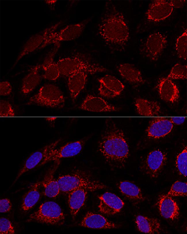 HADHA Antibody in Immunocytochemistry (ICC/IF)