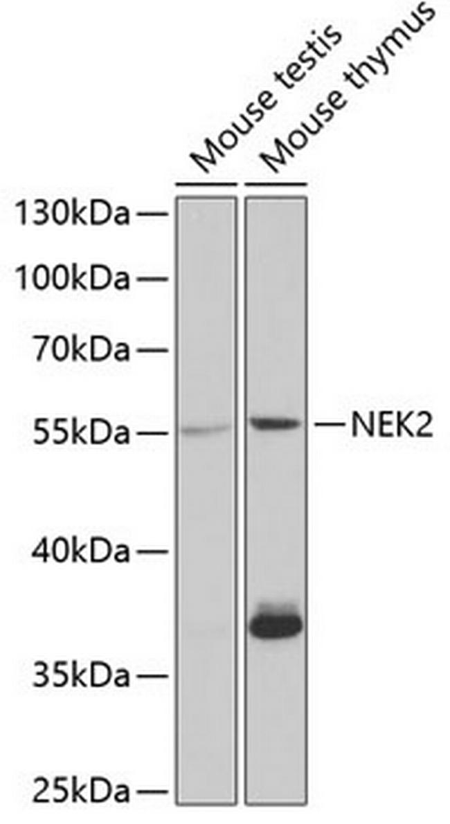 NEK2 Antibody in Western Blot (WB)