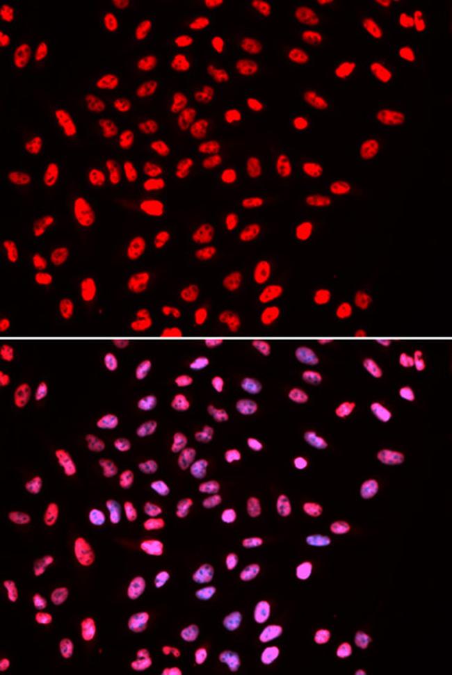 BAF57 Antibody in Immunocytochemistry (ICC/IF)