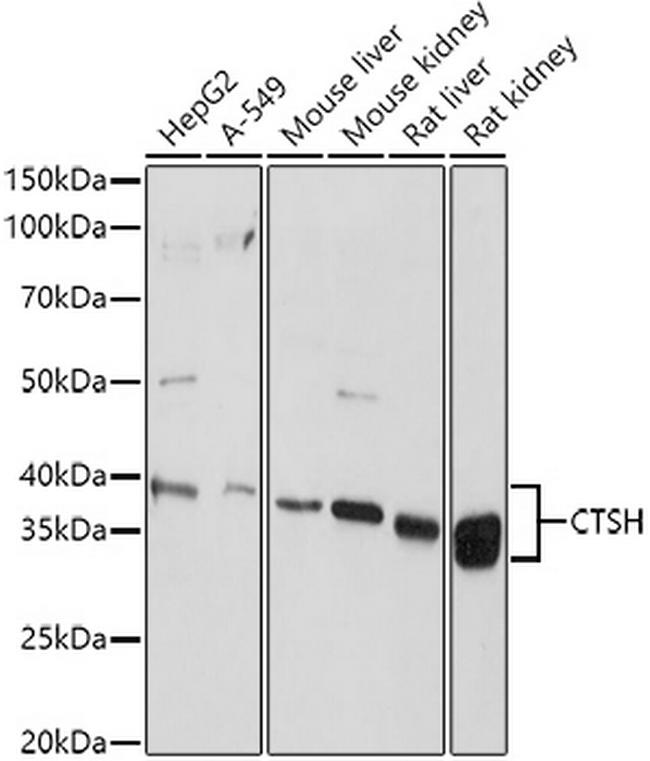 Cathepsin H Antibody in Western Blot (WB)