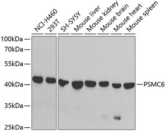 PSMC6 Antibody in Western Blot (WB)