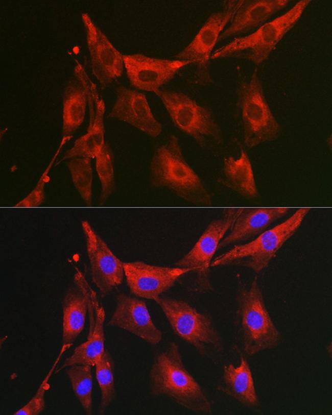 FBP1 Antibody in Immunocytochemistry (ICC/IF)