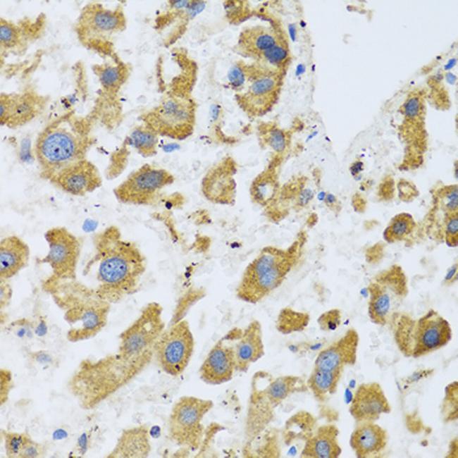 BTD Antibody in Immunohistochemistry (Paraffin) (IHC (P))