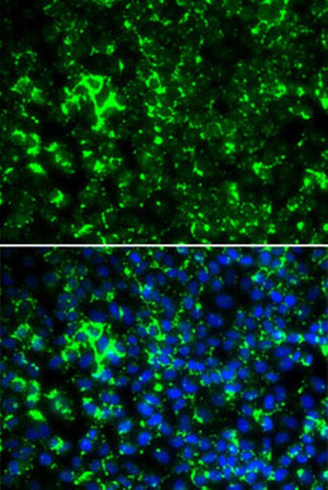 KV1.2 (KCNA2) Antibody in Immunocytochemistry (ICC/IF)