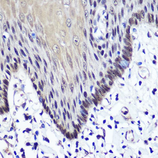 Transketolase Antibody in Immunohistochemistry (Paraffin) (IHC (P))