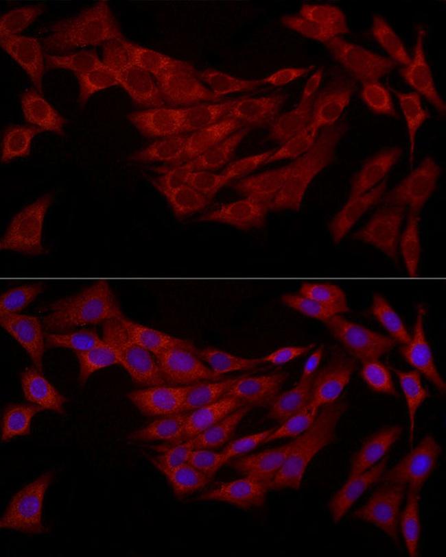 FABP5 Antibody in Immunocytochemistry (ICC/IF)