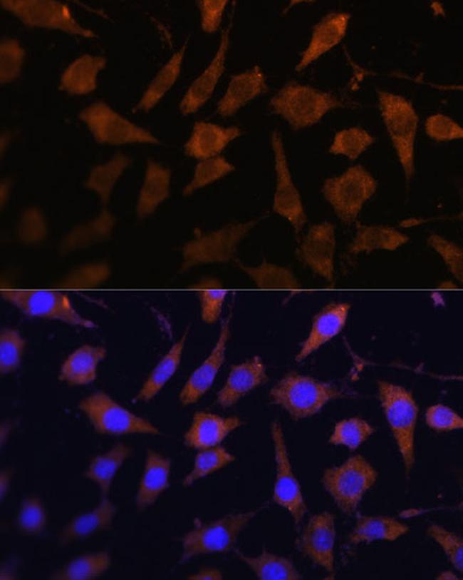 SERPINB9 Antibody in Immunocytochemistry (ICC/IF)