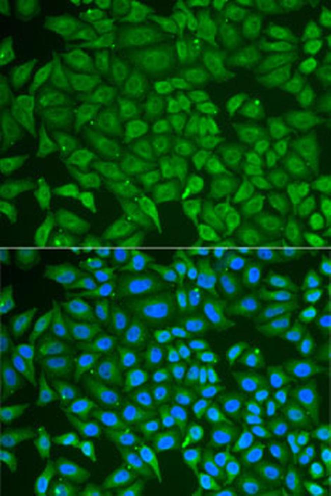 GCDFP-15 Antibody in Immunocytochemistry (ICC/IF)